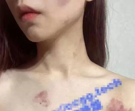 明星吃瓜 抖音百万粉丝博主 雅典娜 Liya 被闺蜜骗去菲律宾卖进场所！-ACGAI艺图