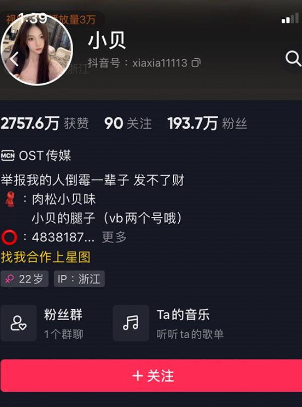 小贝微密照片合集,超甜的她来了-ACGAI艺图