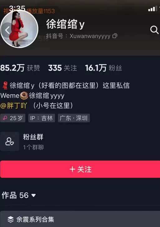 徐绾绾微密照片，定制weme视频-ACGAI艺图