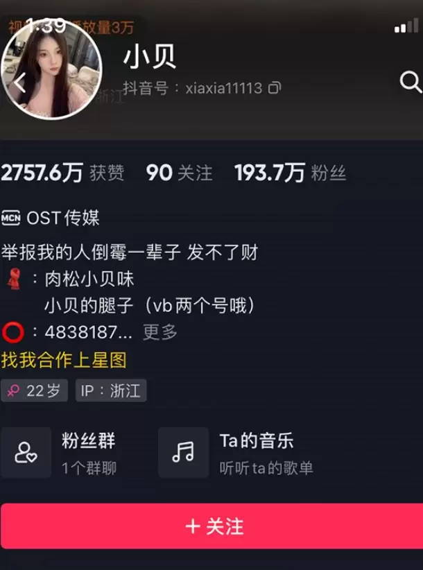 小贝微密照片合集,超甜的她来了-ACGAI艺图